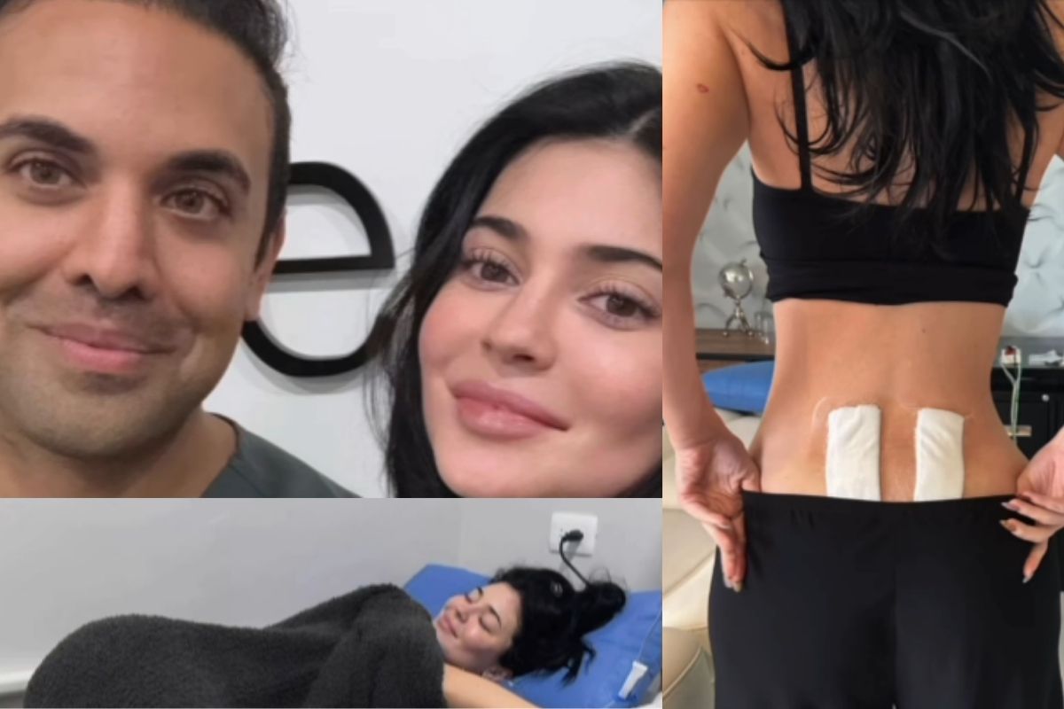 Kylie Jenner BBL Era Officially Dead