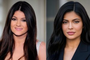 Kylie Jenner Before and After Plastic Surgery